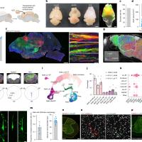 Transplantation of human cortical organoids into the apallial mouse.